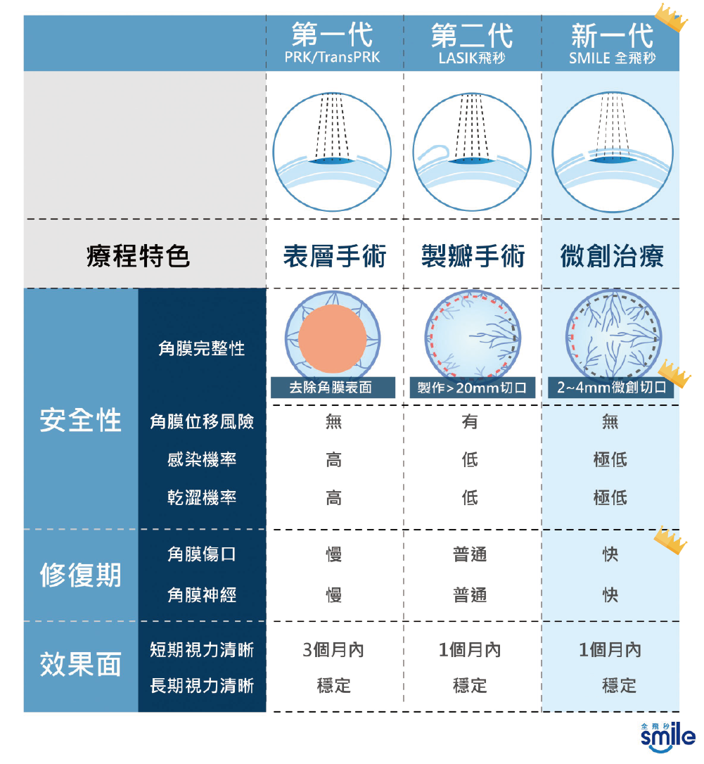 微創近視雷射-文山上明眼科